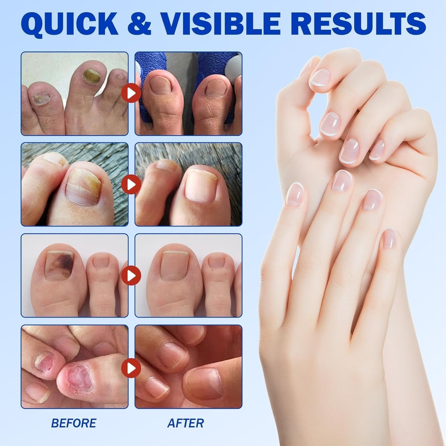 Nail Care Patches
