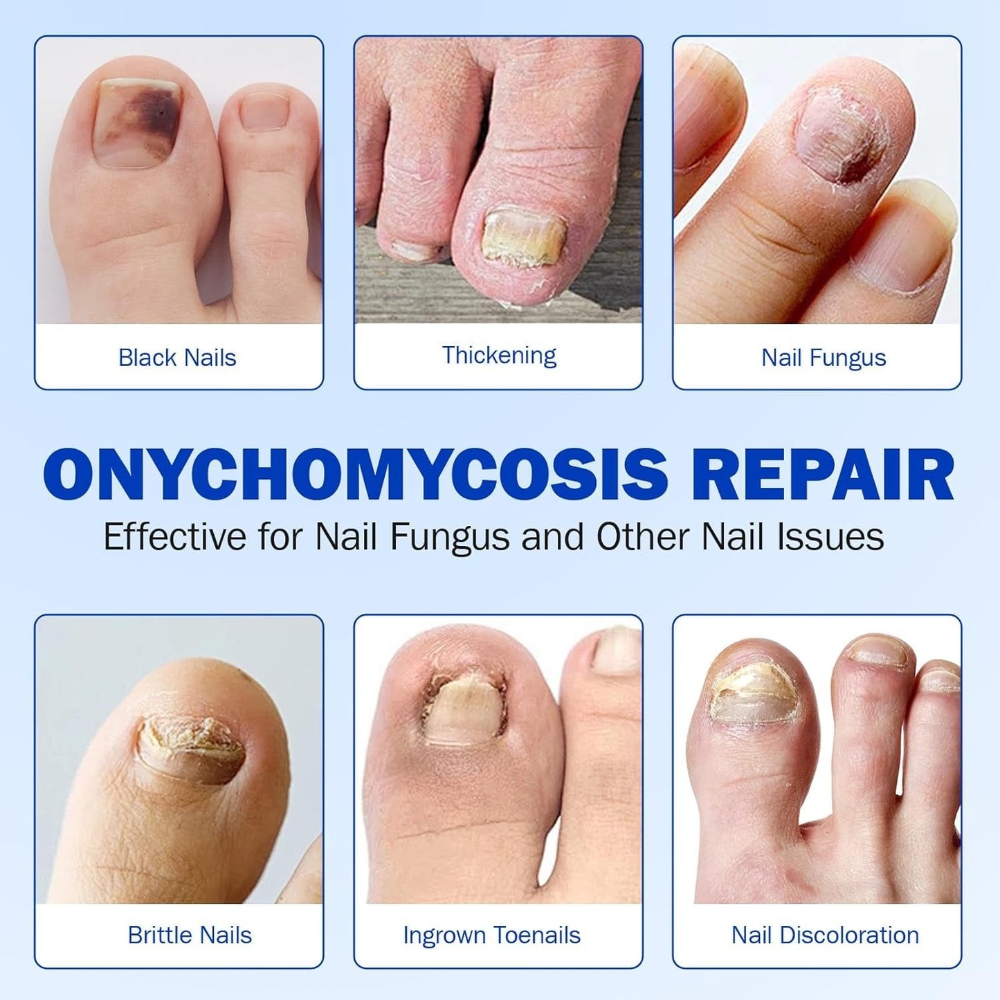 Nail Care Patches