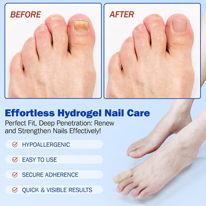 Nail Care Patches