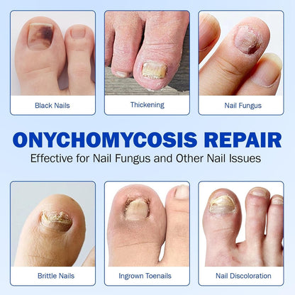 Nail Care Patches